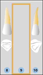 Odontogram showing missing tooth with a yellow box where the tooth would be.